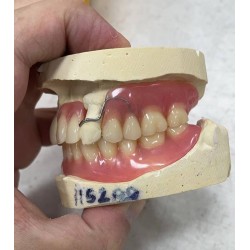 義齒出口 假牙加工廠 義齒外貿  種植牙出口